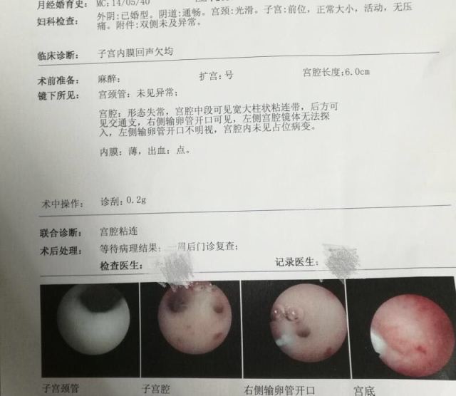 兰州捐卵